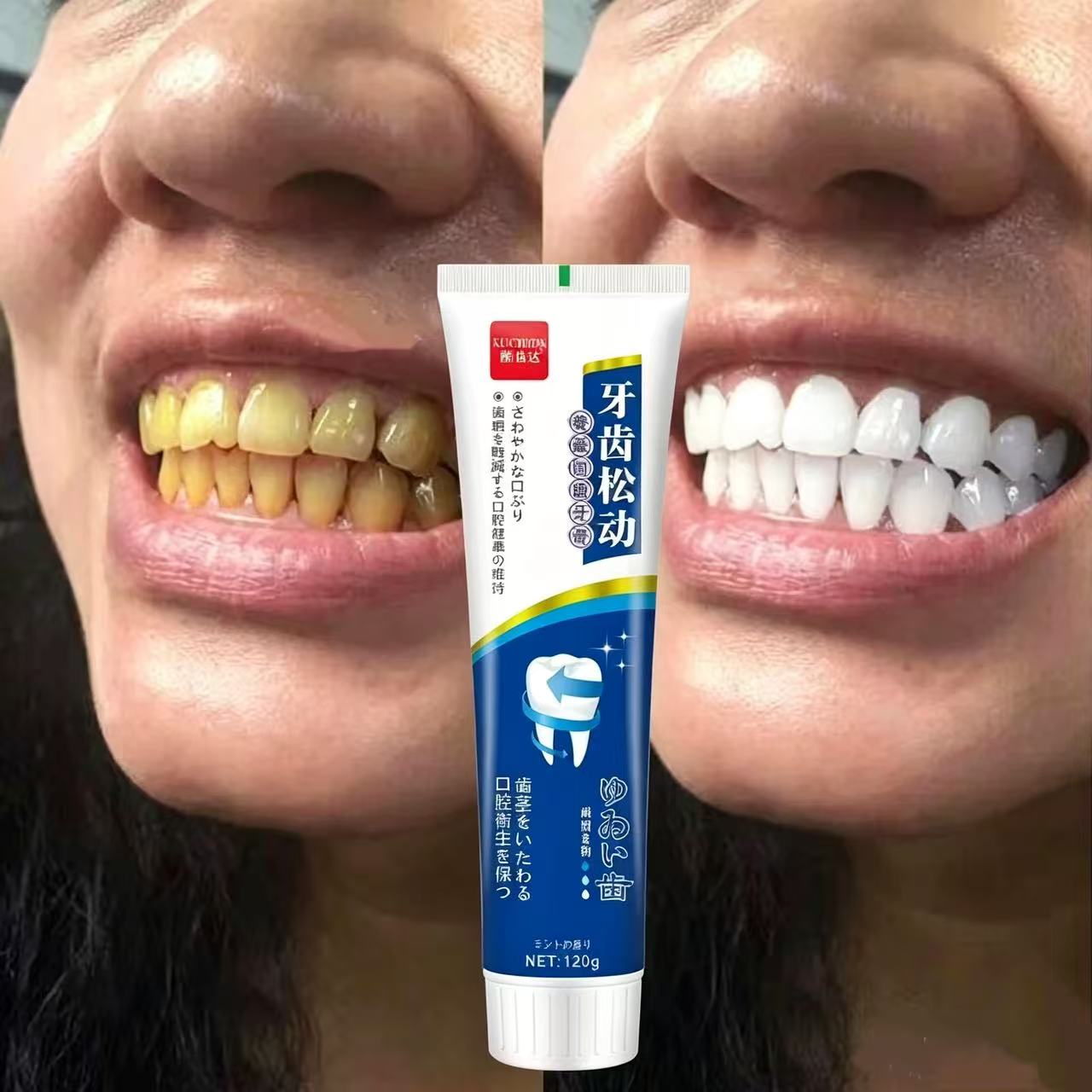 Teeth Whitening Japan - Pasta do zębów importowana z Japonii