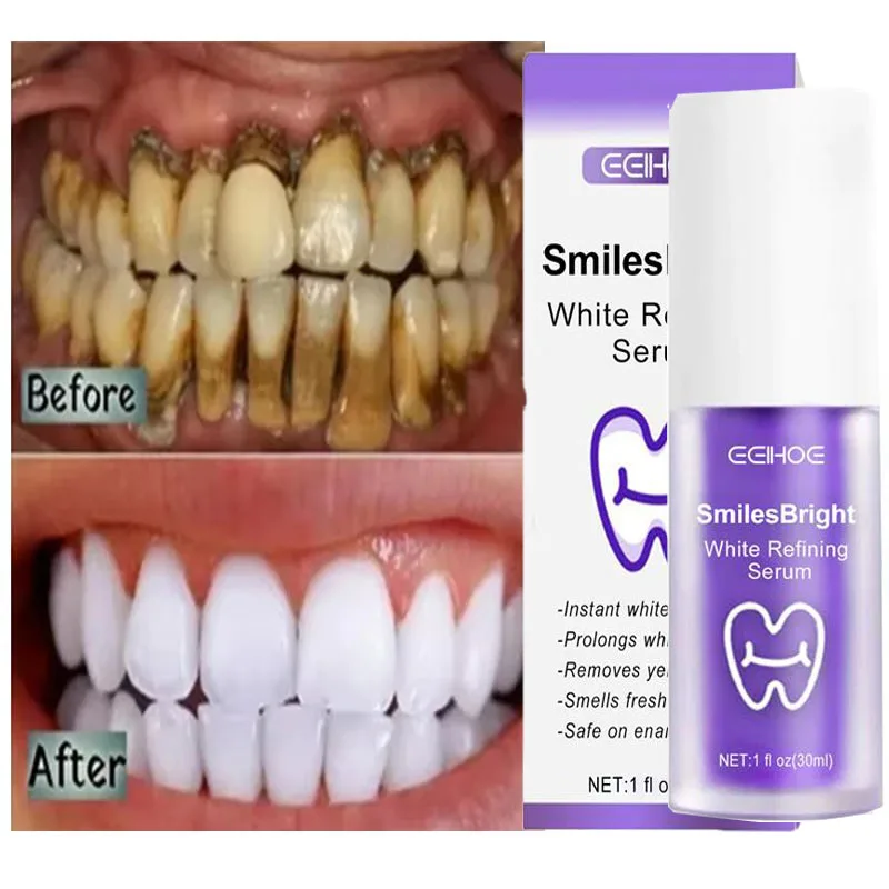 Teeth Whitening Korea - Oczyszczanie zębów Wybielająca pasta do zębów
