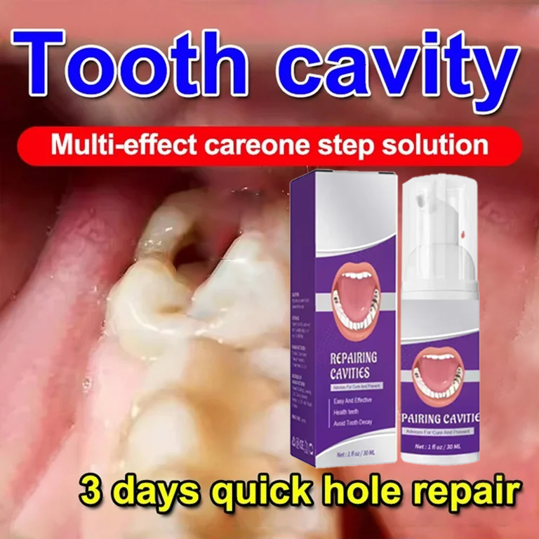 Teeth Whitening Treatment - Czyszczenie zębów Pasta do zębów Usuwa
