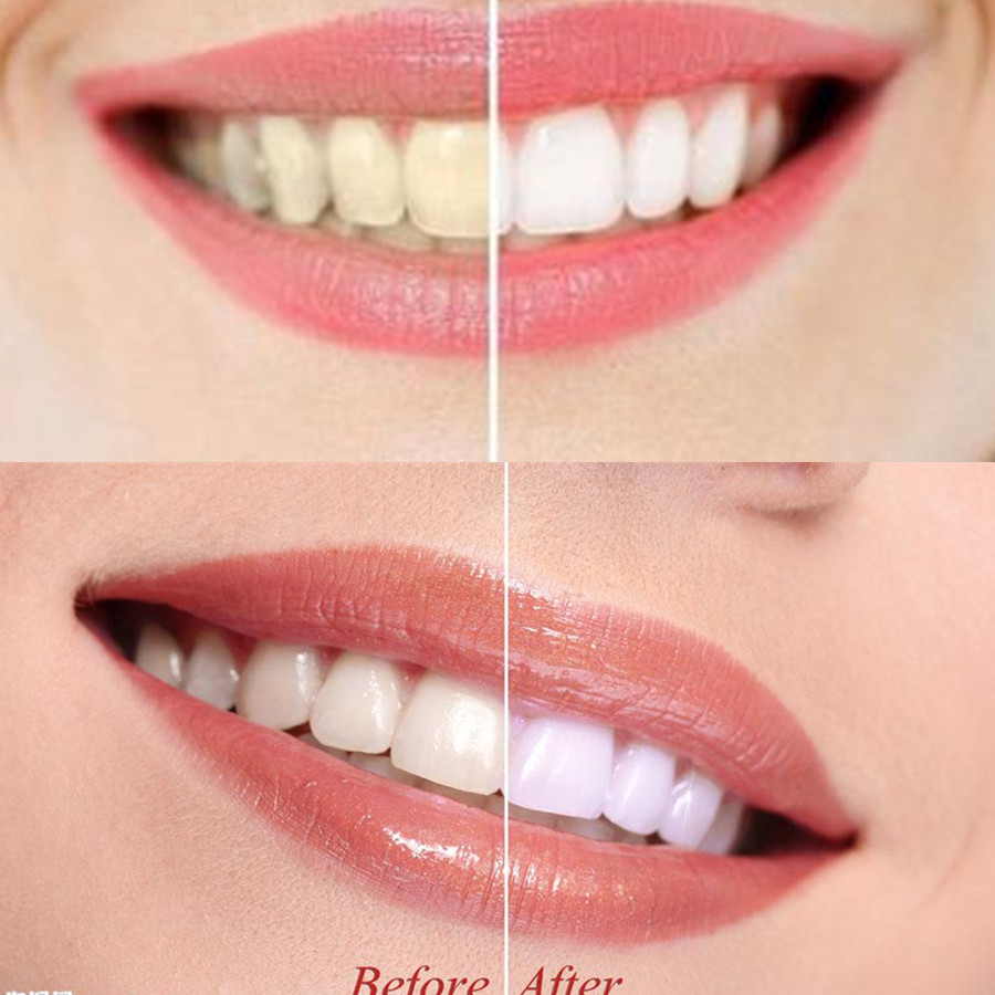 Bambusowy węgiel drzewny zęby  – Teeth Paint Whitening recenzja i cena