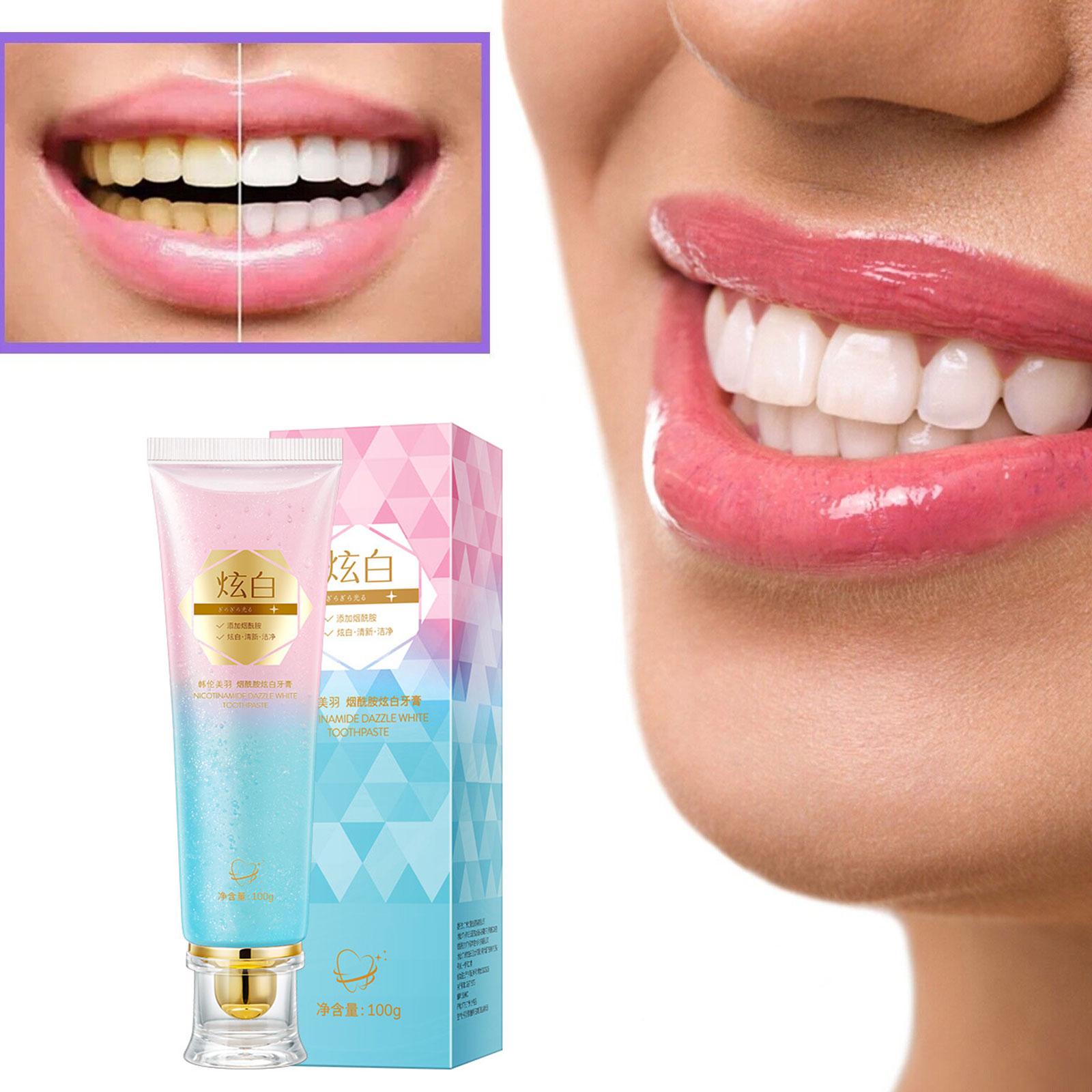 Pasta do zębów z niacynamidem, – Teeth Whitening Treatment recenzja i cena