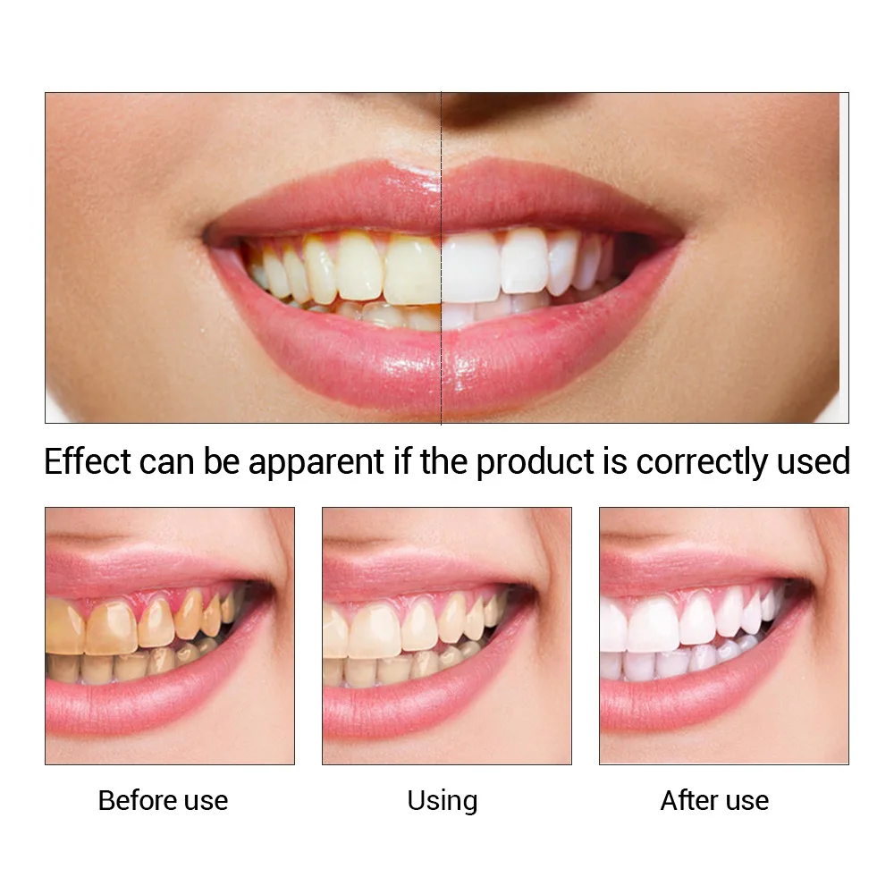 FTEENPLY esencja do wybielania – Teeth Paint Whitening recenzja i cena