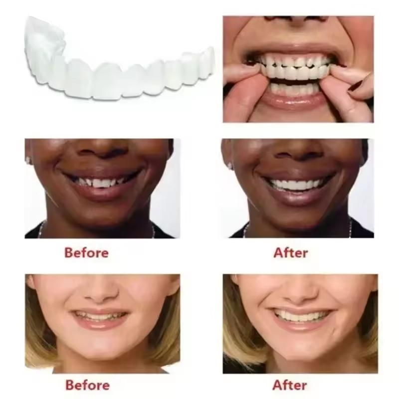 Okładziny na zęby Wybielanie z – Teeth Whitening Vape recenzja i cena