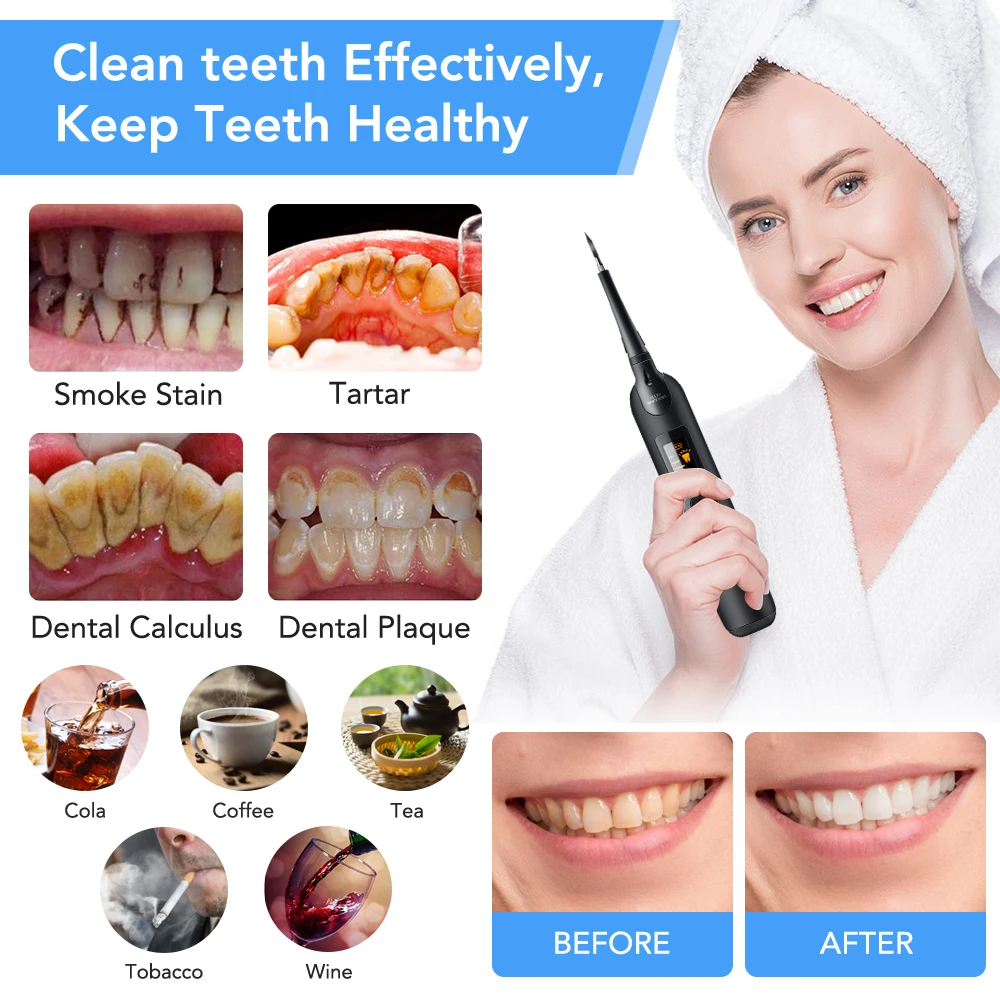 Elektryczny skaler dentystyczn – Teeth Whitening Toothbrush recenzja i cena