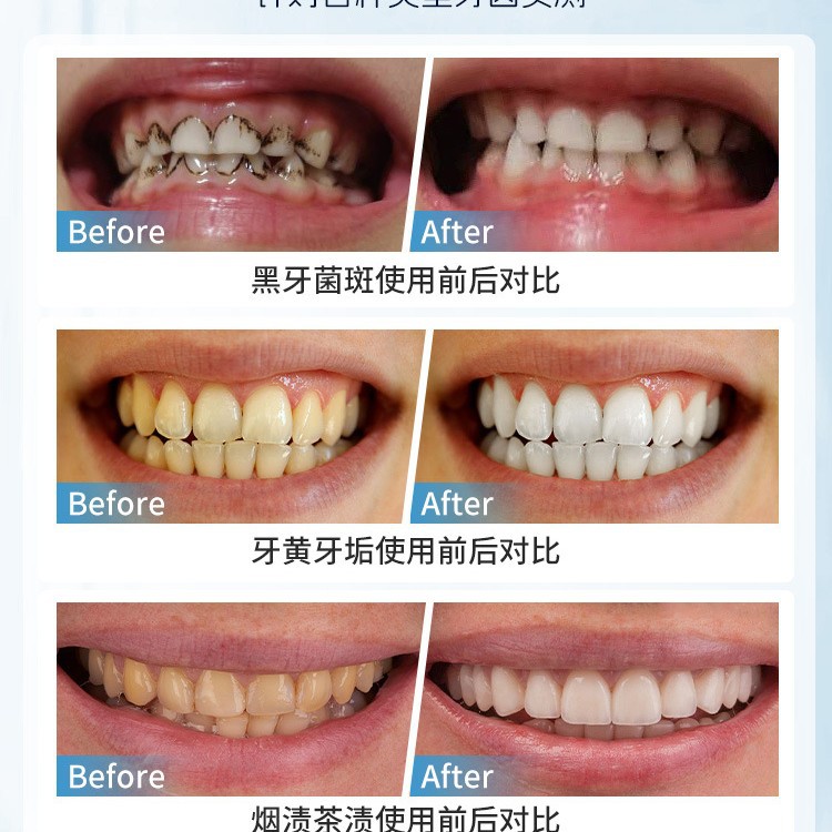 Japońska ręczna szczoteczka do – Teeth Whitening Japan recenzja i cena