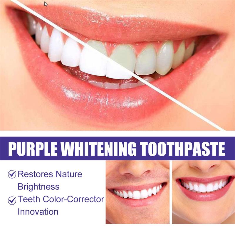 Pasta do zębów wybielająca, że – Teeth Whitening Korea recenzja i cena