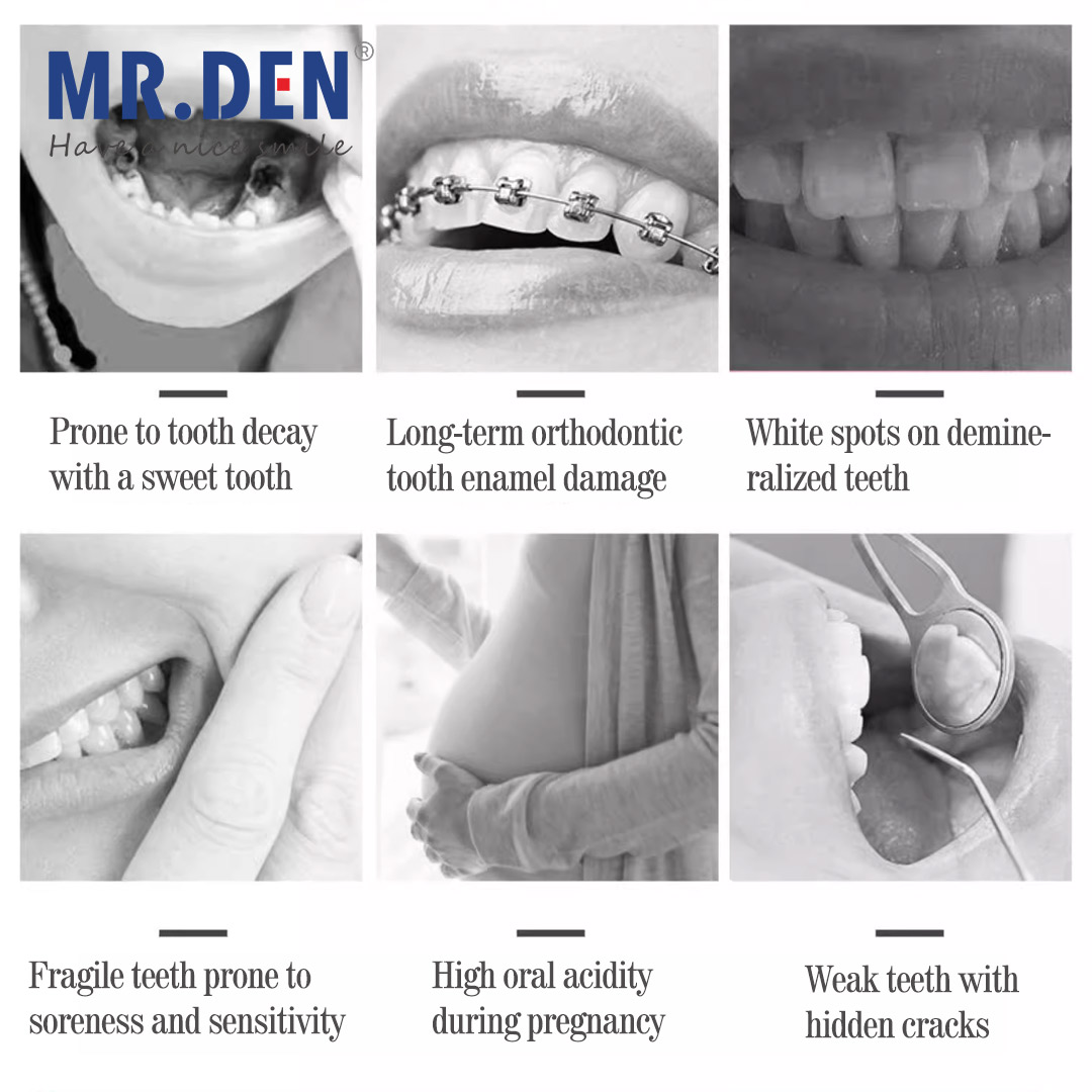 Japan GC Fluoride Enhanced Den – Teeth Whitening Japan recenzja i cena