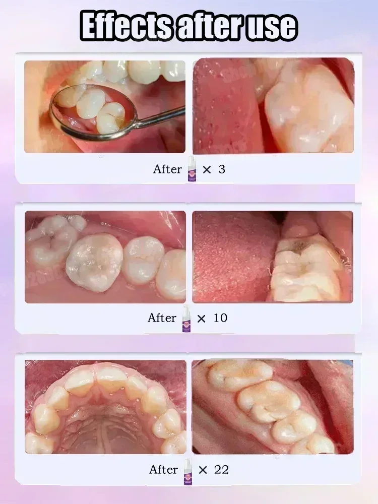 Czyszczenie zębów Pasta do zęb – Teeth Whitening Treatment recenzja i cena
