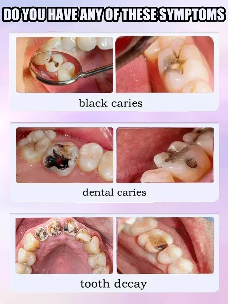 Czyszczenie zębów Pasta do zęb – Teeth Whitening Treatment recenzja i cena